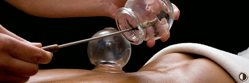 Cupping